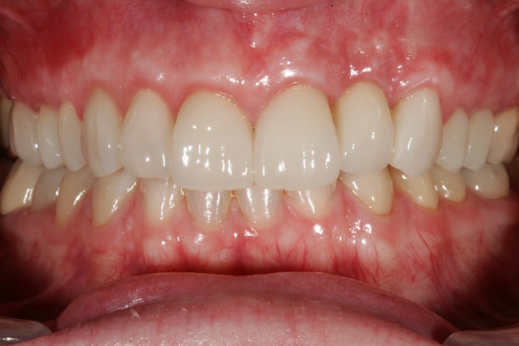Intraoral_nachher_05