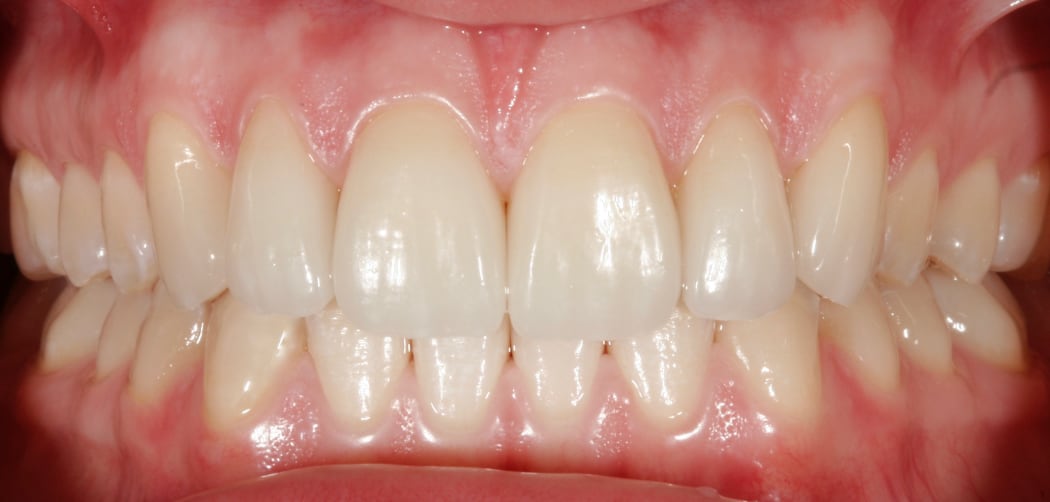 Intraoral_nachher_07