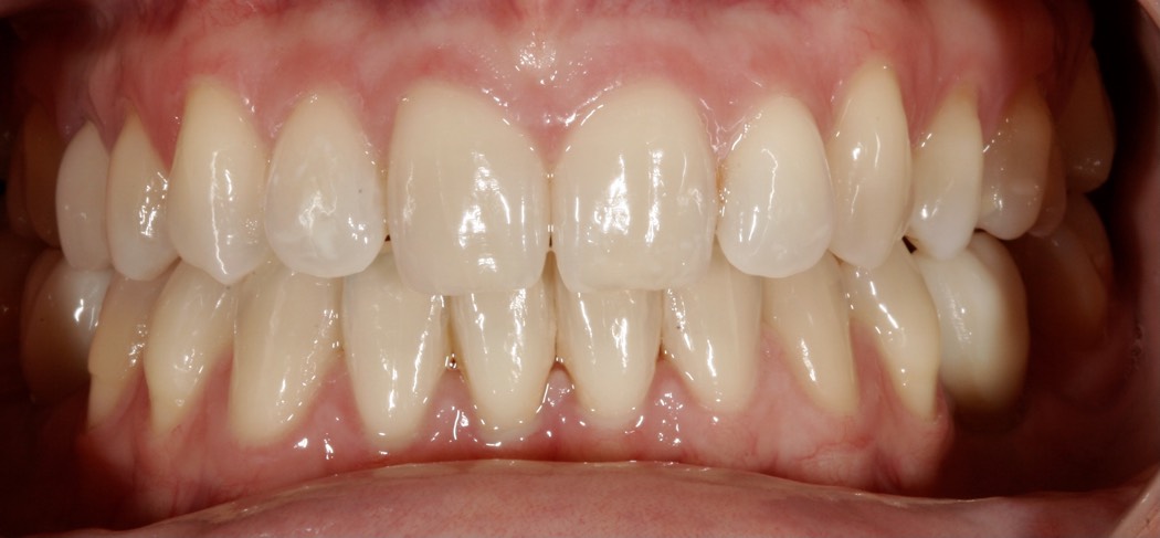 Intraoral_nachher_04